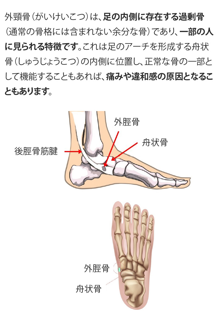 i摜3
