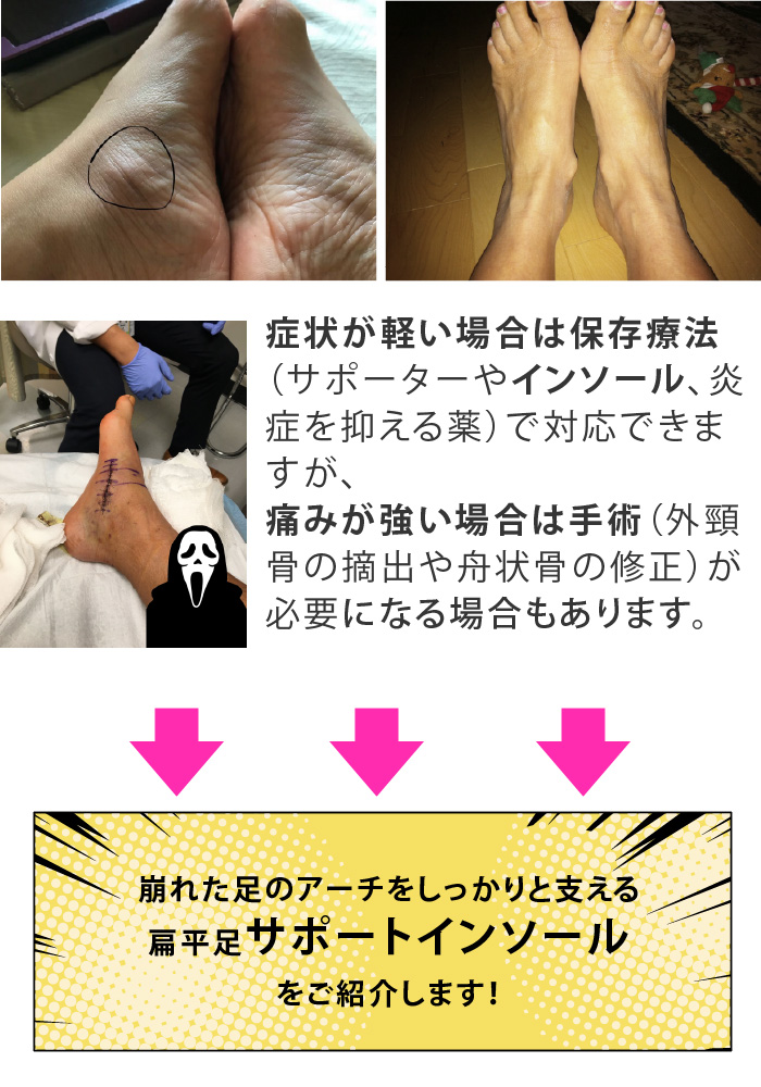 i摜4